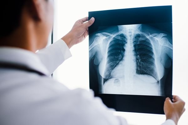 X-RAY